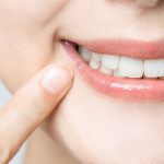 fillings-fail-dentist-wagga